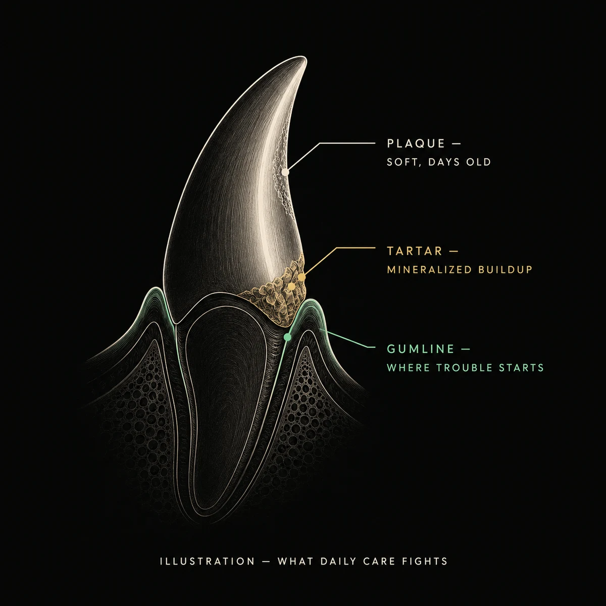 Illustration of a dog tooth showing soft days-old plaque, mineralized tartar, and the gumline where trouble starts: what daily care fights